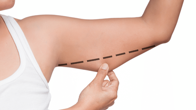 Types of Arm Lift Procedures
