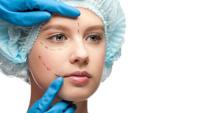 smas facelift