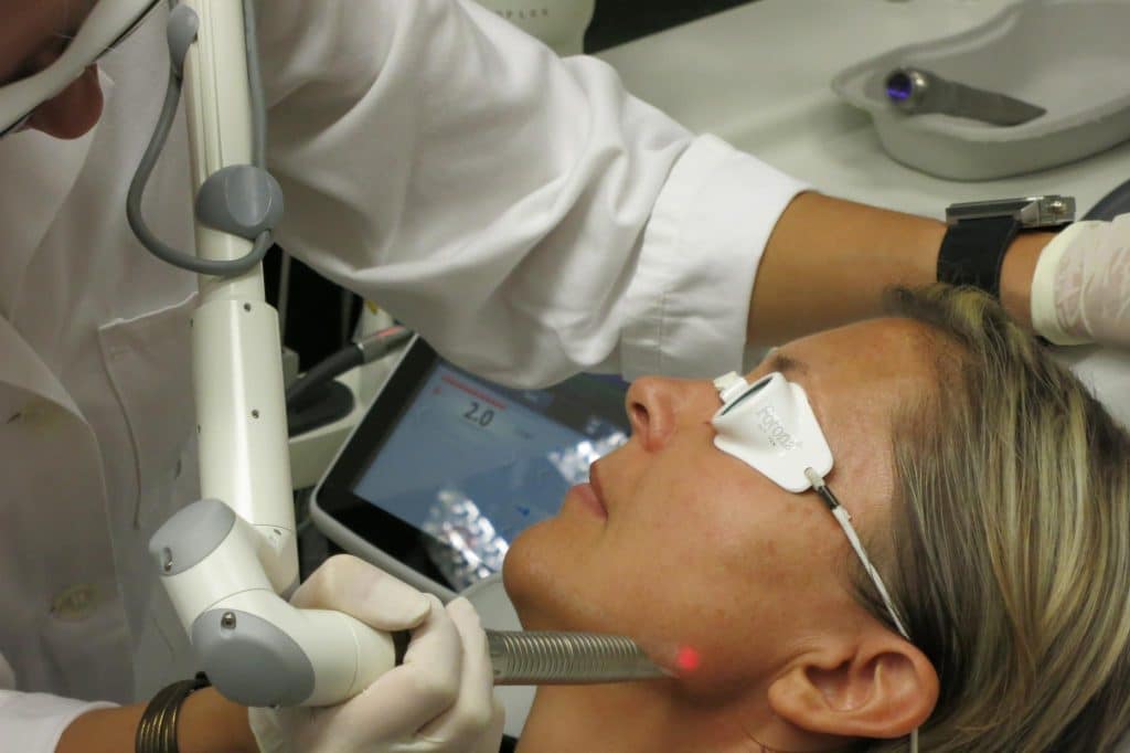Erbium laser resurfacing London
