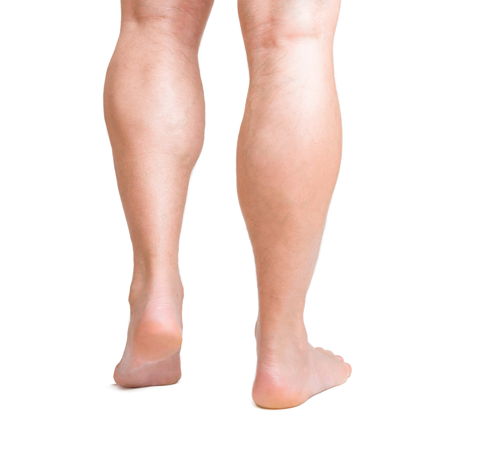 calf augmentation with implants before and after