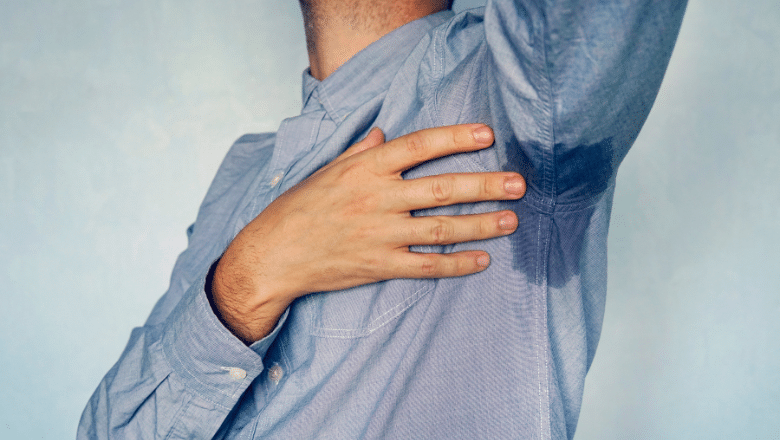 Morpheus8 for excessive armpit sweating — full treatment guide CFS London