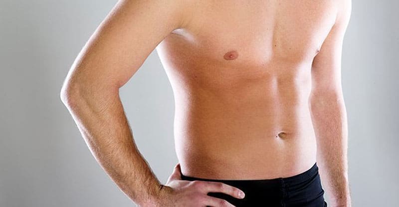 causes of gynaecomastia