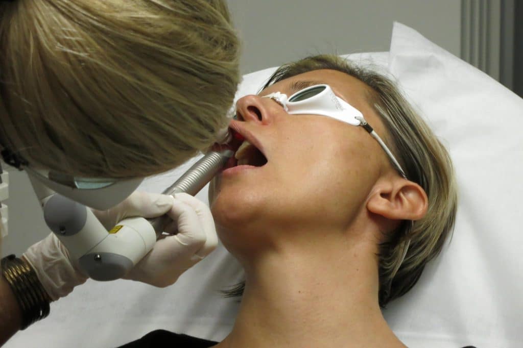 Fotona 4D Step 1 — SmoothLiftin SMOOTH mode applied intra-orally