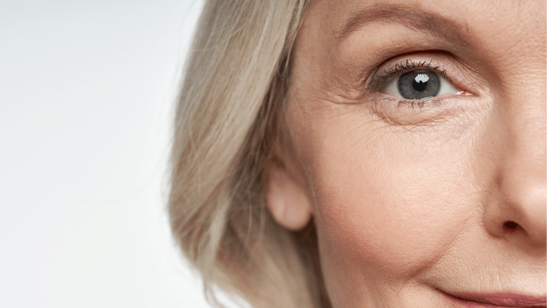 How To Get Rid Of Crow's Feet Without Injections