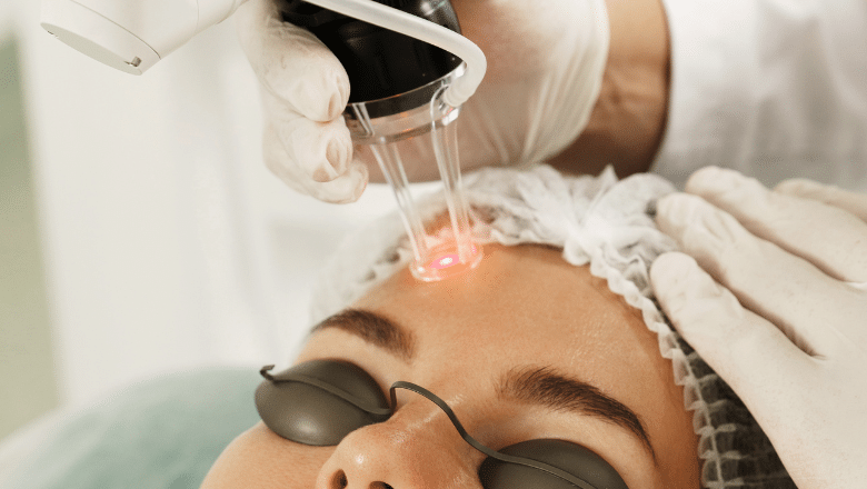 Is laser skin resurfacing painful?