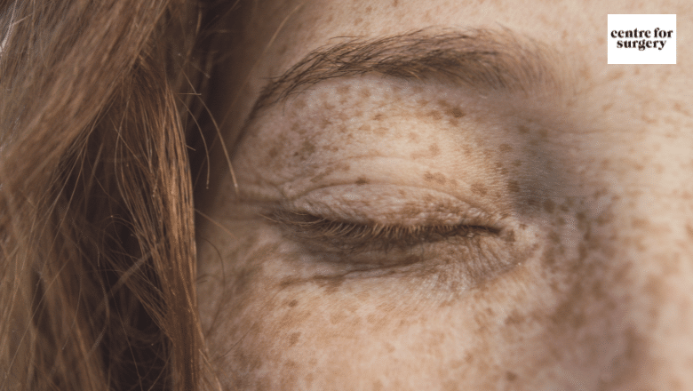 What causes hyperpigmentation