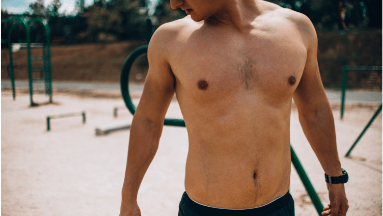 Can Teenagers Get Gynecomastia Surgery