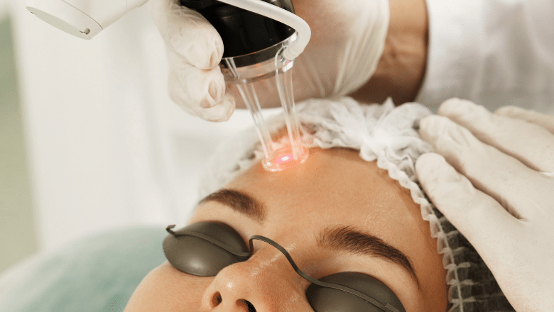 Can Fotona 4D really tighten skin without surgery