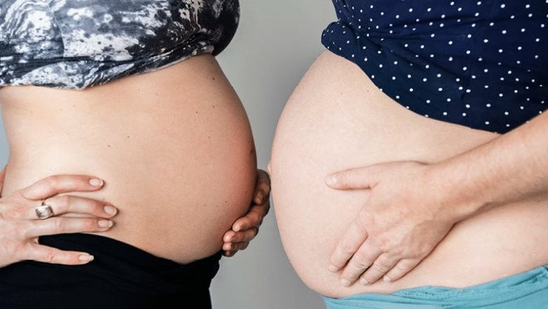 Will A Mummy Makeover Remove Stretch Marks