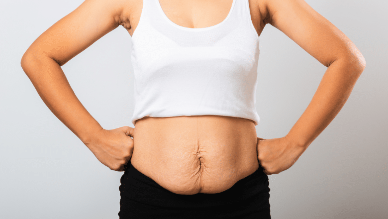 Skin removal surgery after rapid weight loss — Centre for Surgery London