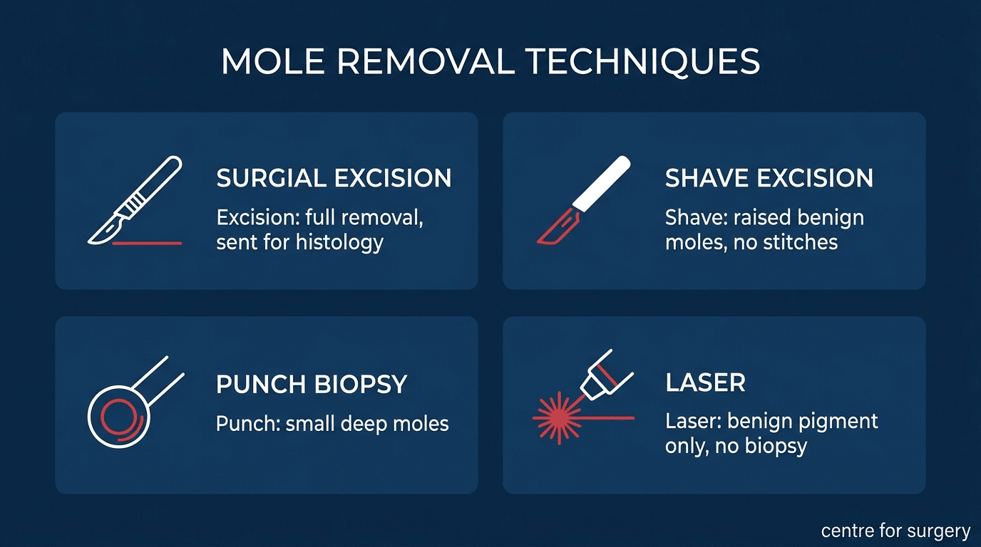 The four mole removal techniques: surgical excision, shave excision, punch biopsy and laser